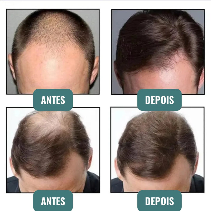Fibra Capilar de Queratina Instantânea - Cabelos Mais Cheios em Segundos